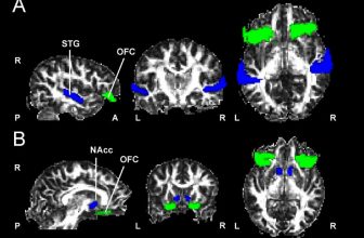 La estructura cerebral refleja las diferencias individuales ante la sensibilidad musical